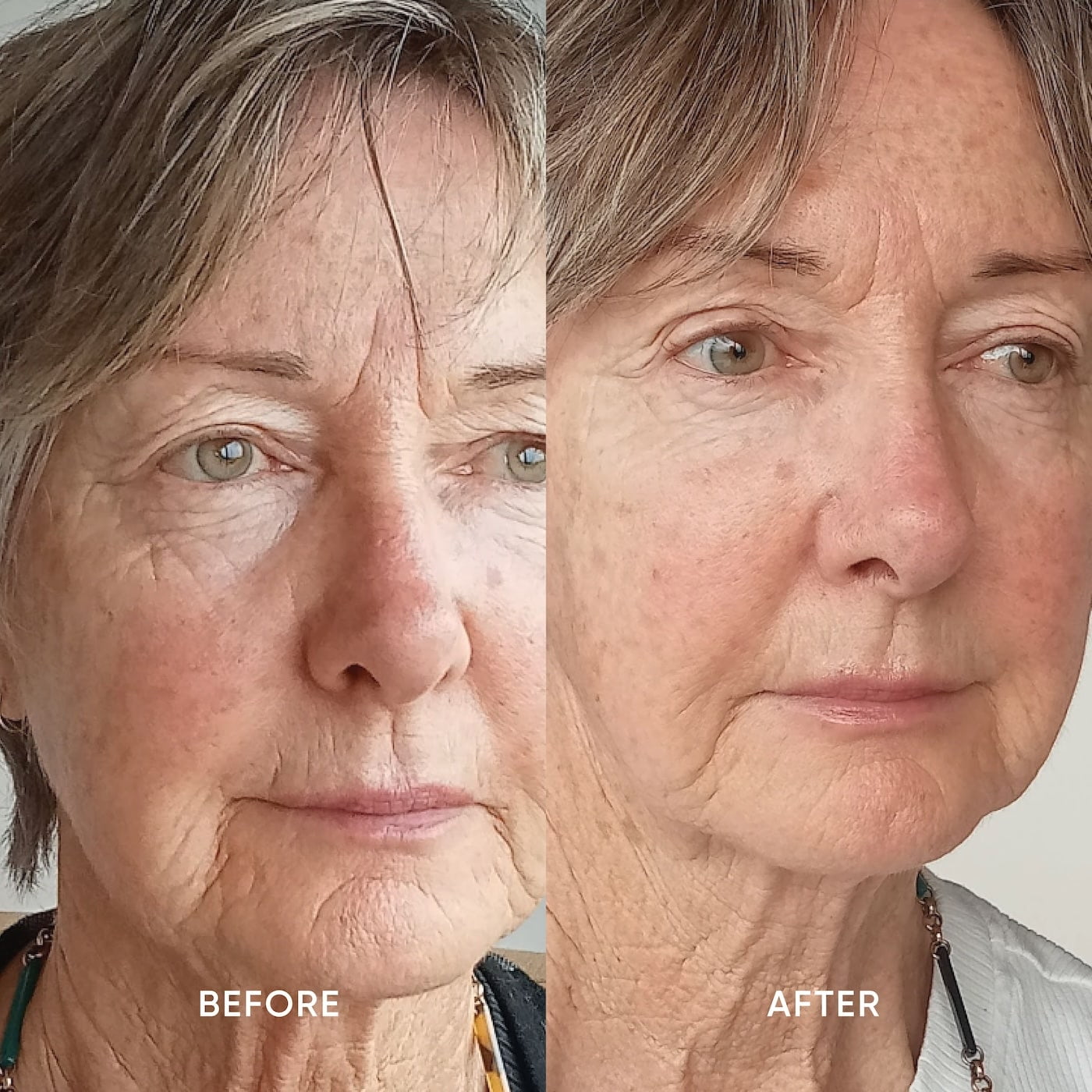 Firming Serum