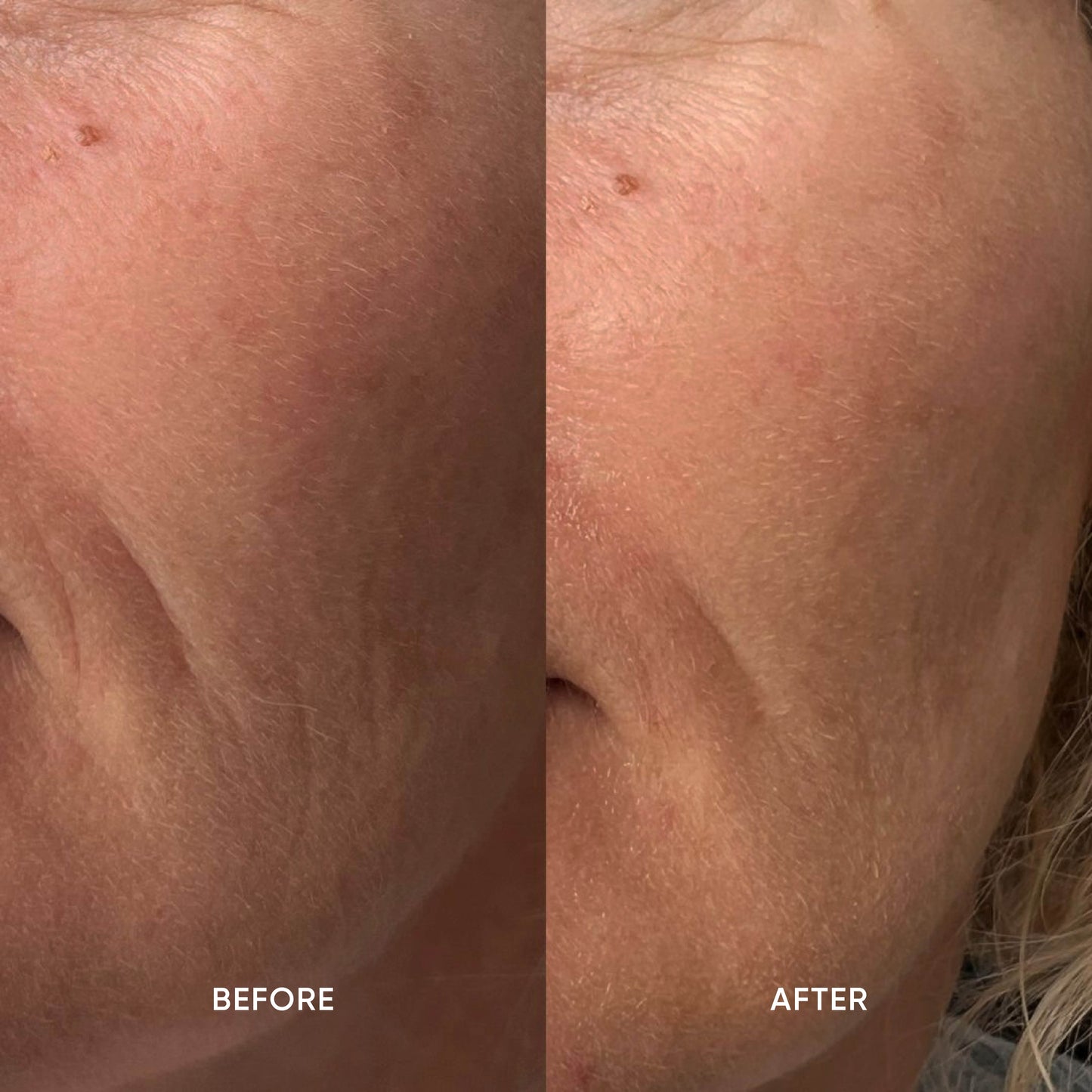 Restorative Skin Oil