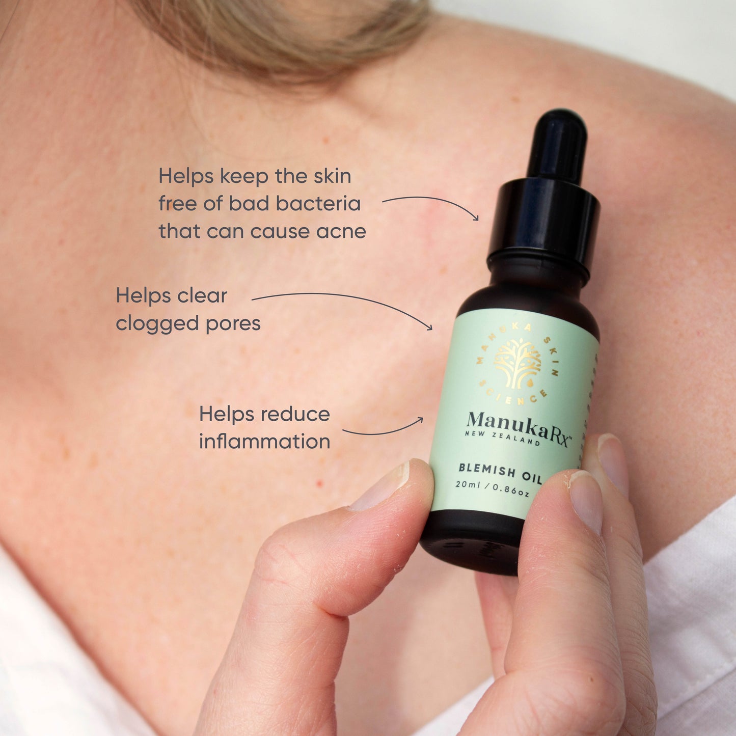Blemish Oil