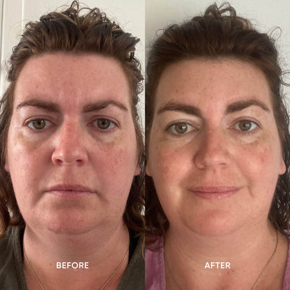 Brightening Eye Cream
